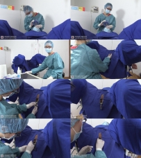 Small Incision